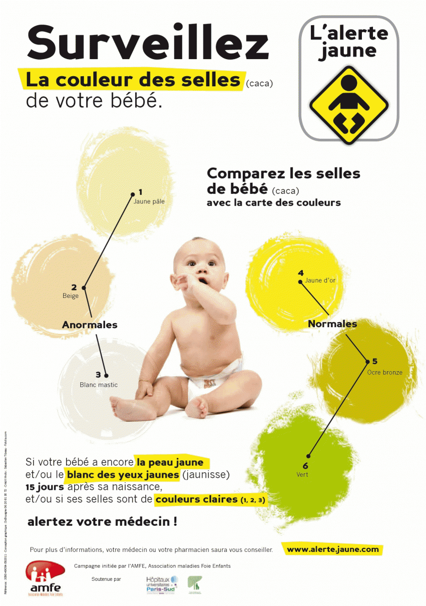 L'alerte jaune : surveillez la couleur des selles de votre bébé